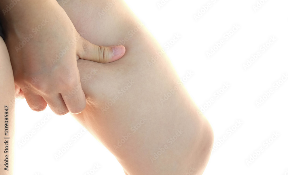 Female legs thighs with cellulite. Skin problem, body care, overweight and dieting concept, diabetic risk factor. Female legs thighs with cellulite. Skin problem, body care, overweight and dieting concept, diabetic risk factor.