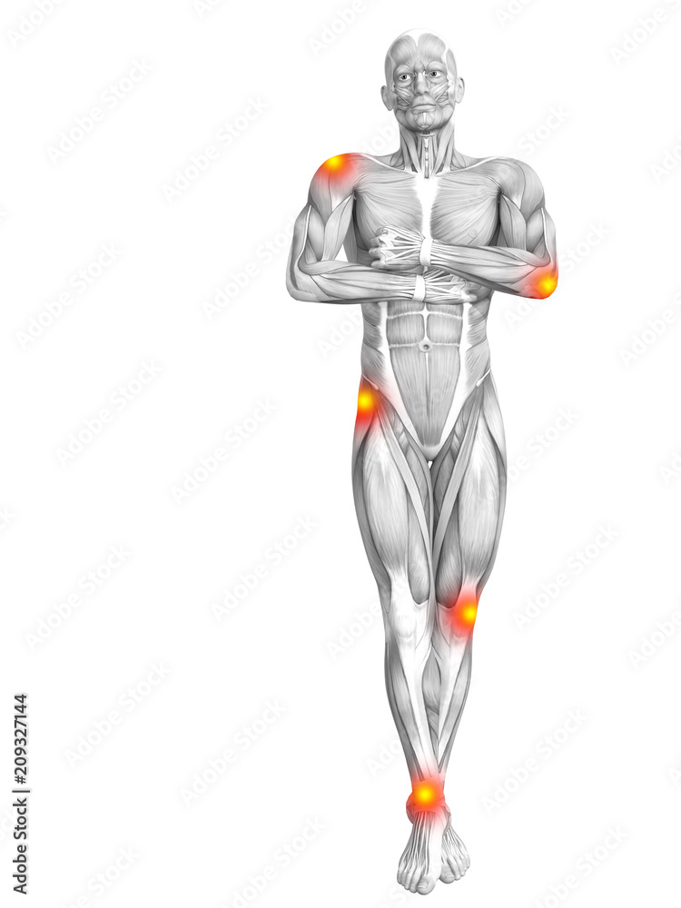 Conceptual human muscle anatomy with red and yellow hot spot inflammation or articular joint pain for health care therapy or sport concepts. 3D illustration man arthritis or bone osteoporosis disease