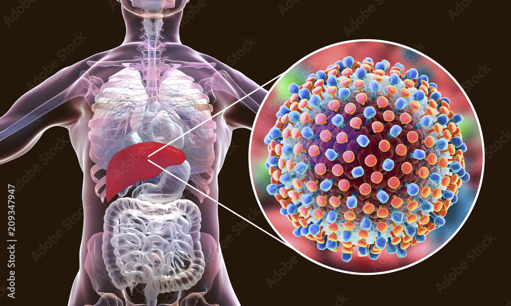 Hepatitis C virus infection medical concept, 3D illustration - obrazy, fototapety, plakaty 