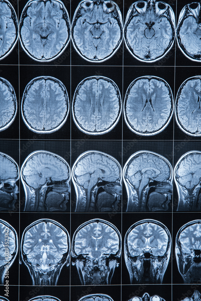 Photo & Art Print Magnetic resonance imaging of the head and brain, MRI ...
