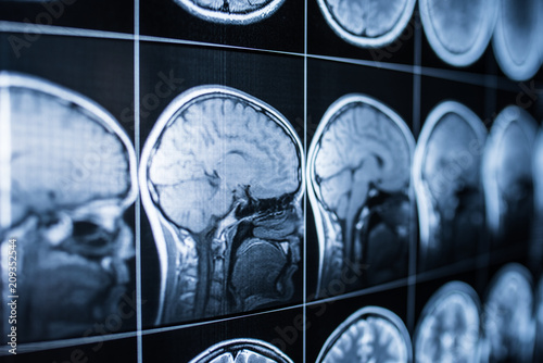 Fotografia, Obraz X-ray of the head and brain of a person