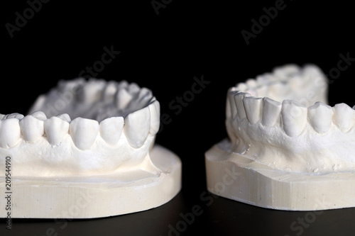 Upper and lower teeth made of plaster