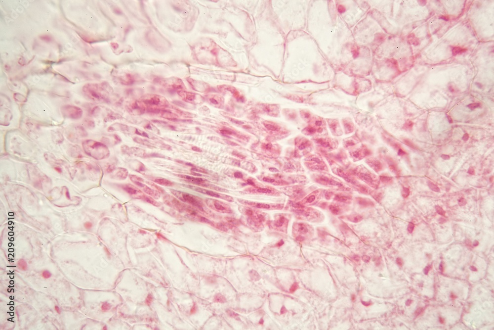 Root bacteria nodules under the microscope. Root bacteria nodules under the microscope.