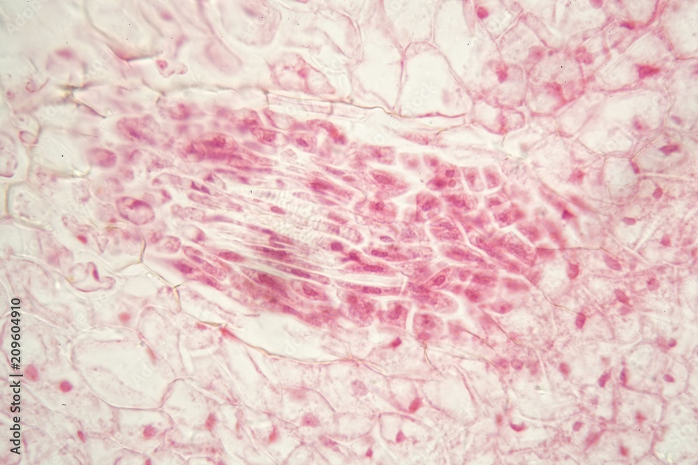 Root bacteria nodules under the microscope.