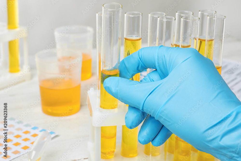Laboratory worker taking test tube with urine sample from holder, closeup. Urology concept Laboratory worker taking test tube with urine sample from holder, closeup. Urology concept