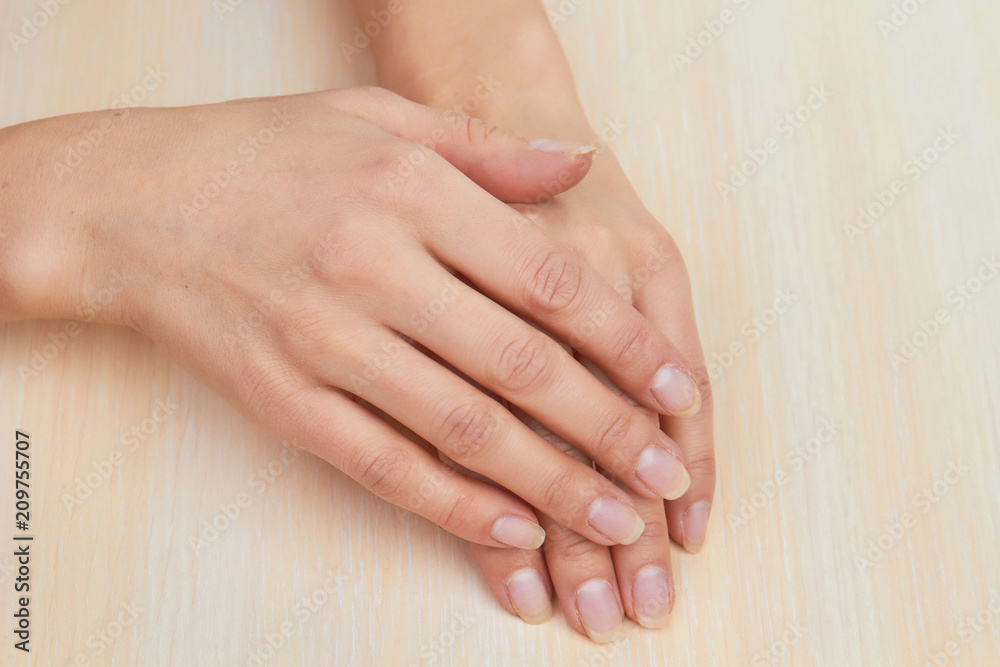 Female hands with short natural nails. Girl hands without manicure on salon  table. Skin and nails spa treatment. Photos | Adobe Stock
