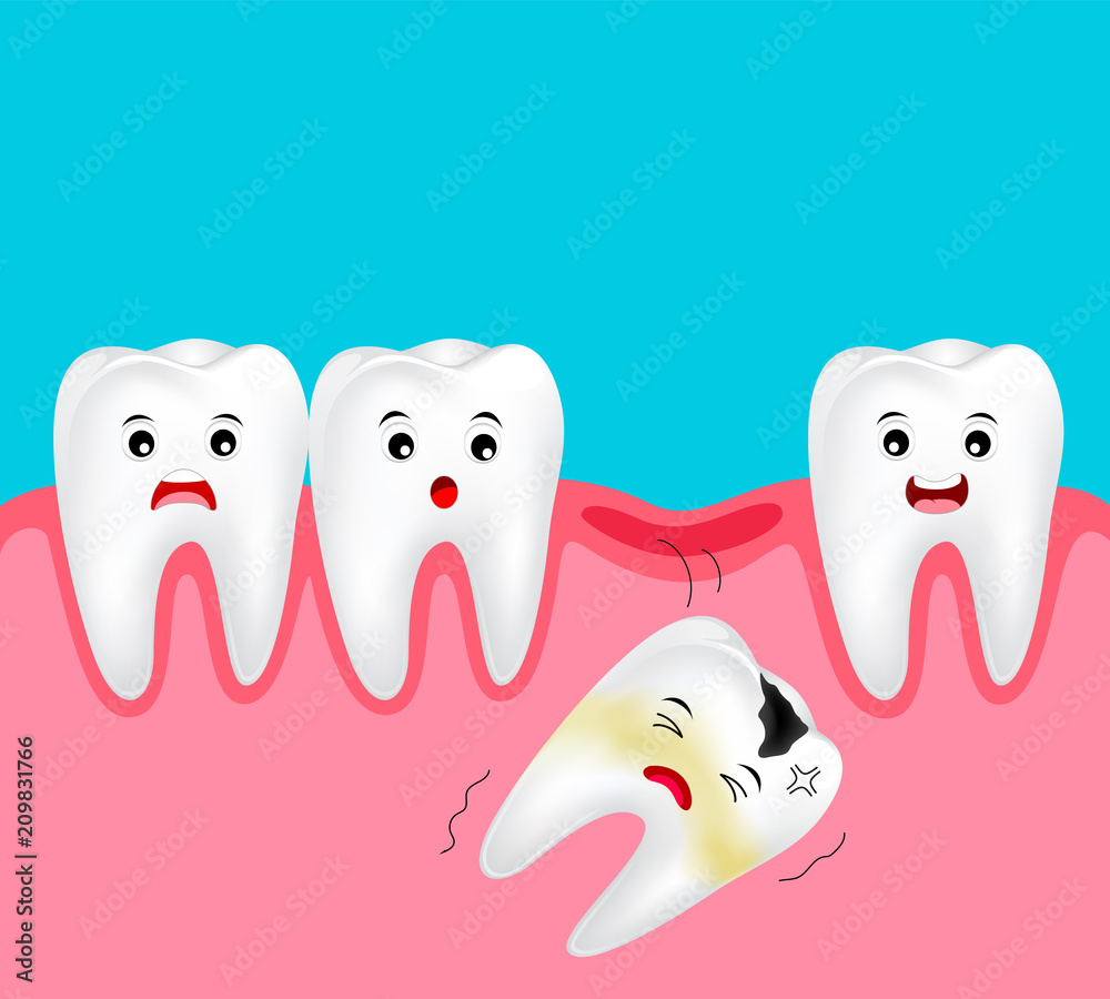 Cute cartoon missing tooth. Dental cartoon character. Dental care concept. Illustration isolated on blue background. Cute cartoon missing tooth. Dental cartoon character. Dental care concept. Illustration isolated on blue background.
