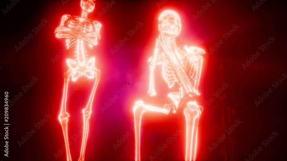 man in wheelchair with visible bones man in wheelchair with visible bones