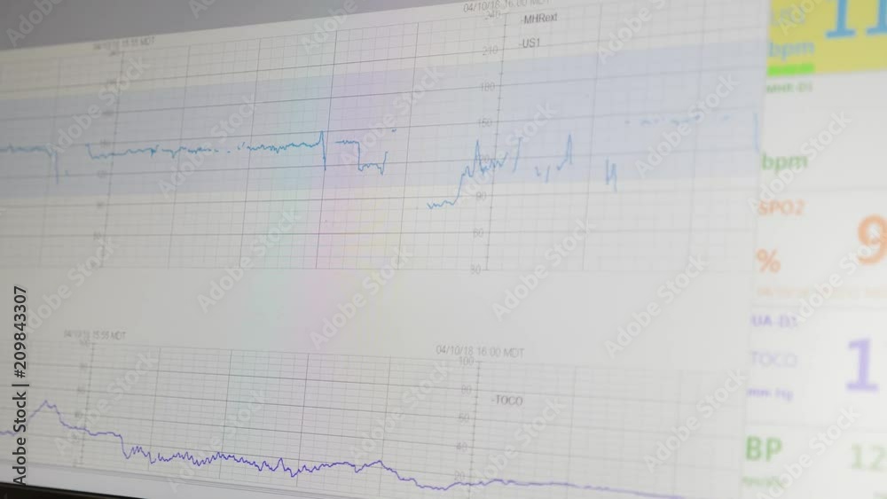 A machine at the hospital to monitor and measure a babies heart beat