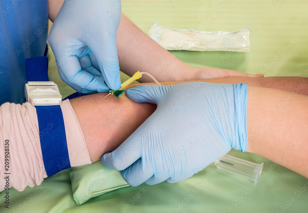 Nurse taking blood sample from a vein of a child Nurse taking blood sample from a vein of a child