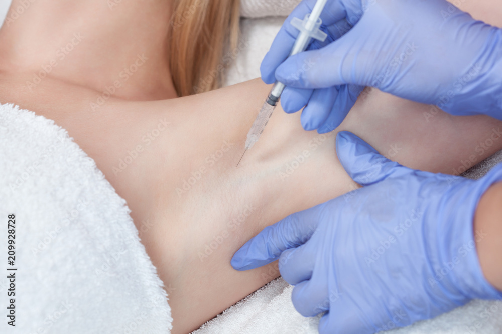 The doctor makes intramuscular injections of botulinum toxin in the underarm area against hyperhidrosis. The doctor makes intramuscular injections of botulinum toxin in the underarm area against hyperhidrosis.