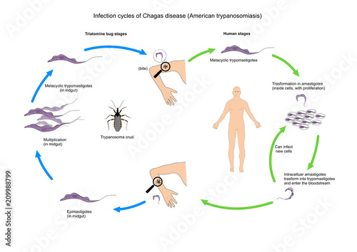 Chagas disease, or american trypanosomiasis, a tropical parasitic disease. photo