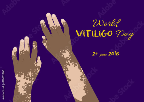 World Vitiligo day poster