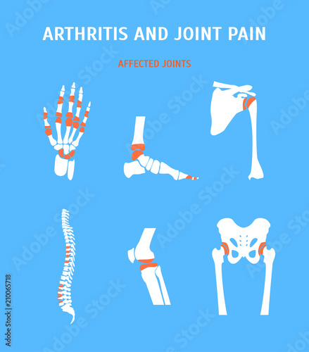 Cartoon Arthritis and Joint Pain Set. Vector