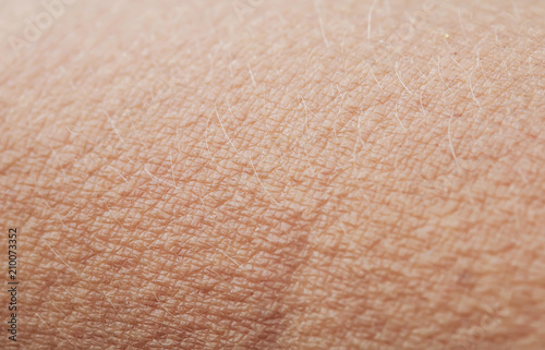 human skin covered with small goosebumps and hairs from the cold and fright close-up