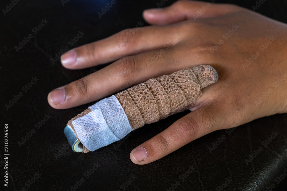 Amazon.com: Wisesso Trigger Finger Splint, Finger Splints for Straightening  & Trigger Finger & Broken Finger,Finger Brace Fits Index Finger - Middle  Finger - Ring Finger (Blue-4pcs, One Size) : Health & Household