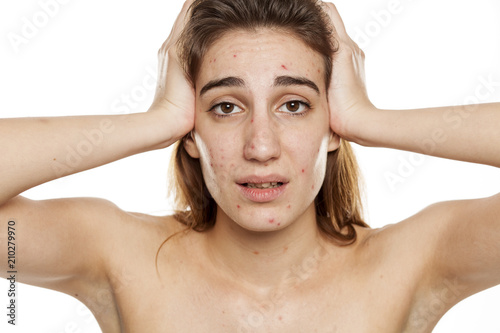 young unhappy woman with problematic skin and without makeup squeeze her acne on a white background