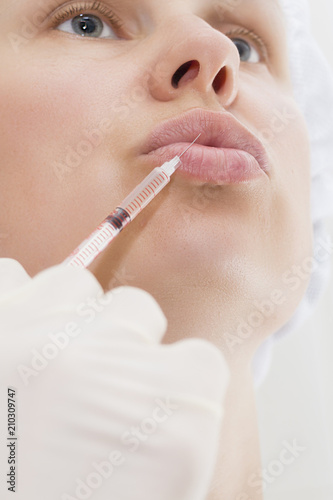 young woman gets injection in her lips. Woman in beauty salon. plastic surgery clinic.