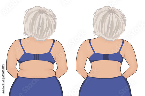 Fat and slim girl's back. Fat thig. Liposuction. Before and after. Woman body correction vector illustration photo