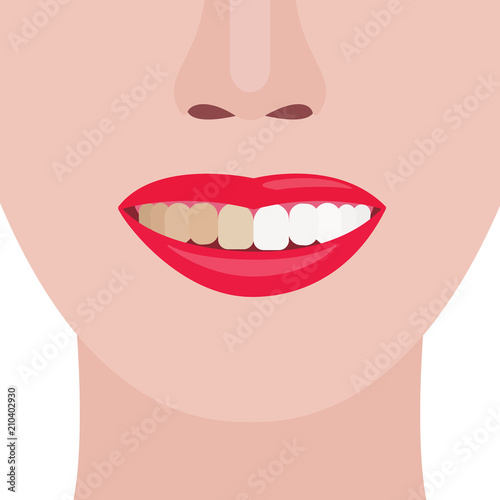 Face girl. Smile with dirty and clean teeth. Vector illustration