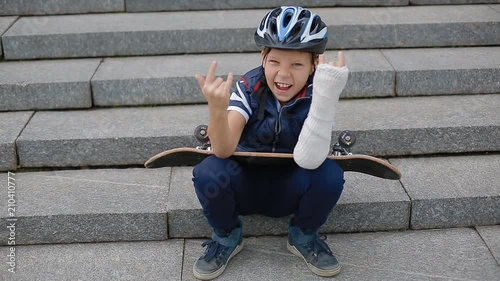 White boy with broken arm makng the rock sign sitting on the granite stairs with his skateboard. photo