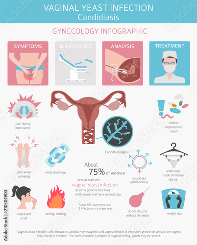 Vaginal yeast infection. Candidiasis. Ginecological medical desease infographic
