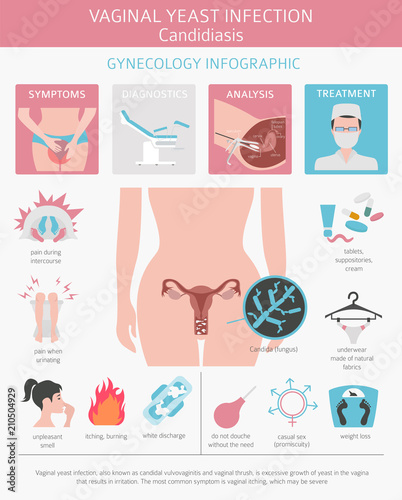 Vaginal yeast infection. Candidiasis. Ginecological medical desease infographic