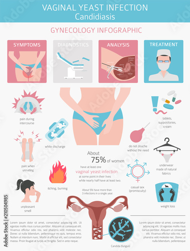 Vaginal yeast infection. Candidiasis. Ginecological medical desease infographic