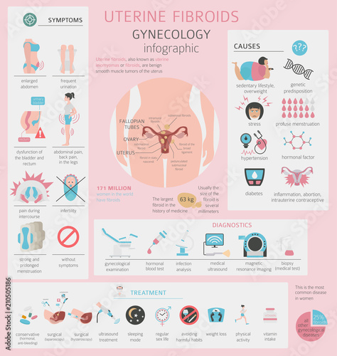 Uterine fibroids. Ginecological medical desease in women infographic