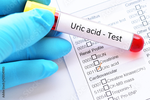 Blood sample tube with laboratory requisition form for uric acid test, gouty arthritis diagnosis photo