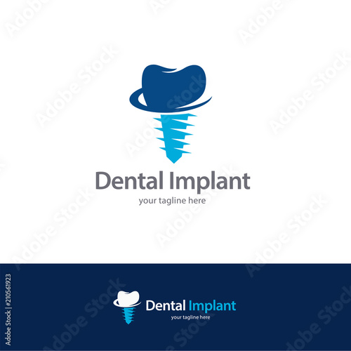 Dental Implant Logo Design Template