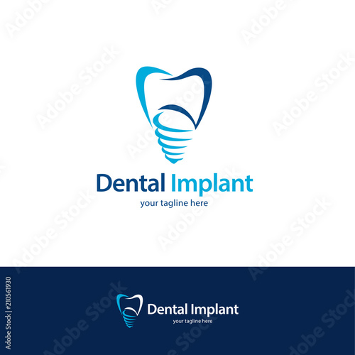 Dental Implant Logo Design Template