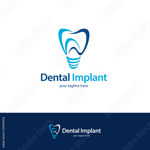 Dental Implant Logo Design Template