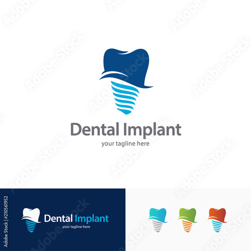 Dental Implant Logo Design Template