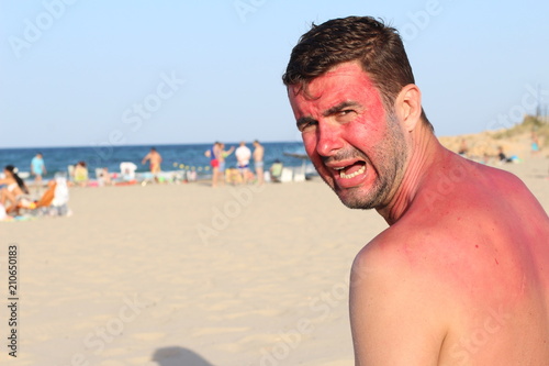 White man at the beach during heatwave 