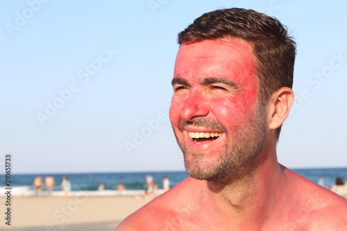 Man smiling while getting sunburned 