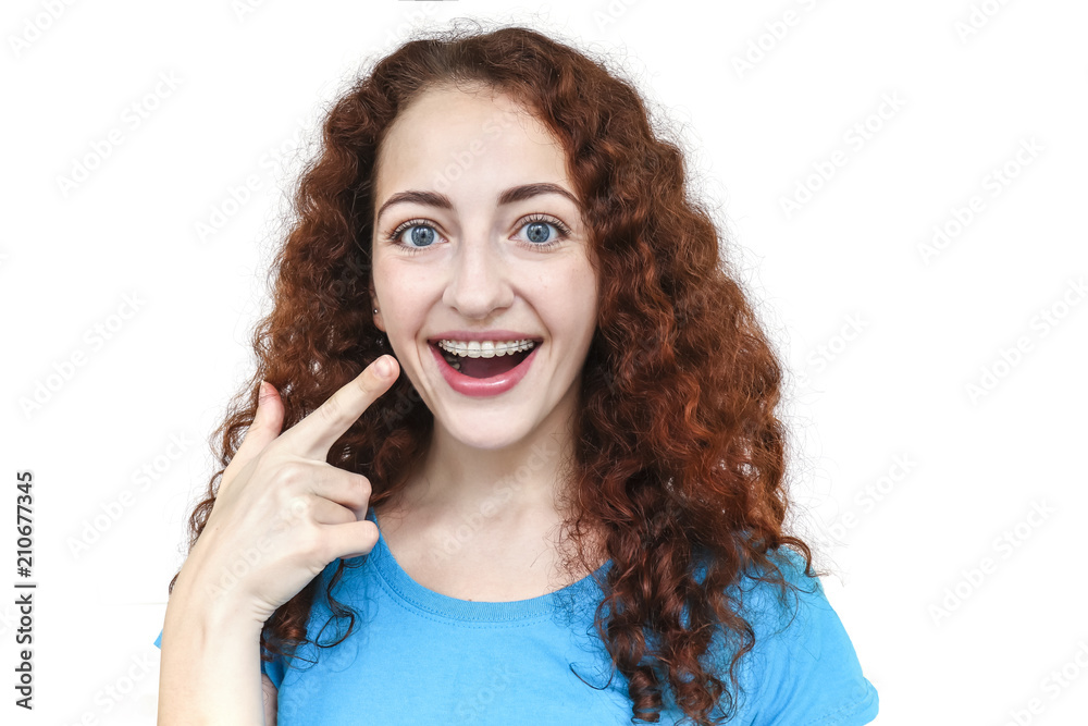 Girl in braces. Young european woman smiling in ceramic braces. Pointing a finger at her teeth. Dressed in a blue T-shirt. Happy smile. Girl with curly red hair Isolated on white background Girl in braces. Young european woman smiling in ceramic braces. Pointing a finger at her teeth. Dressed in a blue T-shirt. Happy smile. Girl with curly red hair Isolated on white background