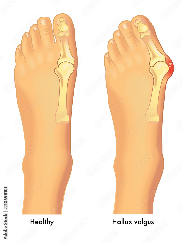 feet фотография Stock Adobe Stock