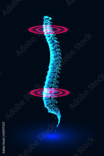 Spine diagnostics. Banner. Abstract image of a starry sky or space, consisting of points, lines, and shapes in the form of planets, stars and the universe. Low poly vector