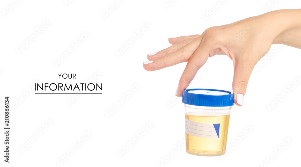 Plastic container with urine in hand analysis pattern on white background isolation Plastic container with urine in hand analysis pattern on white background isolation