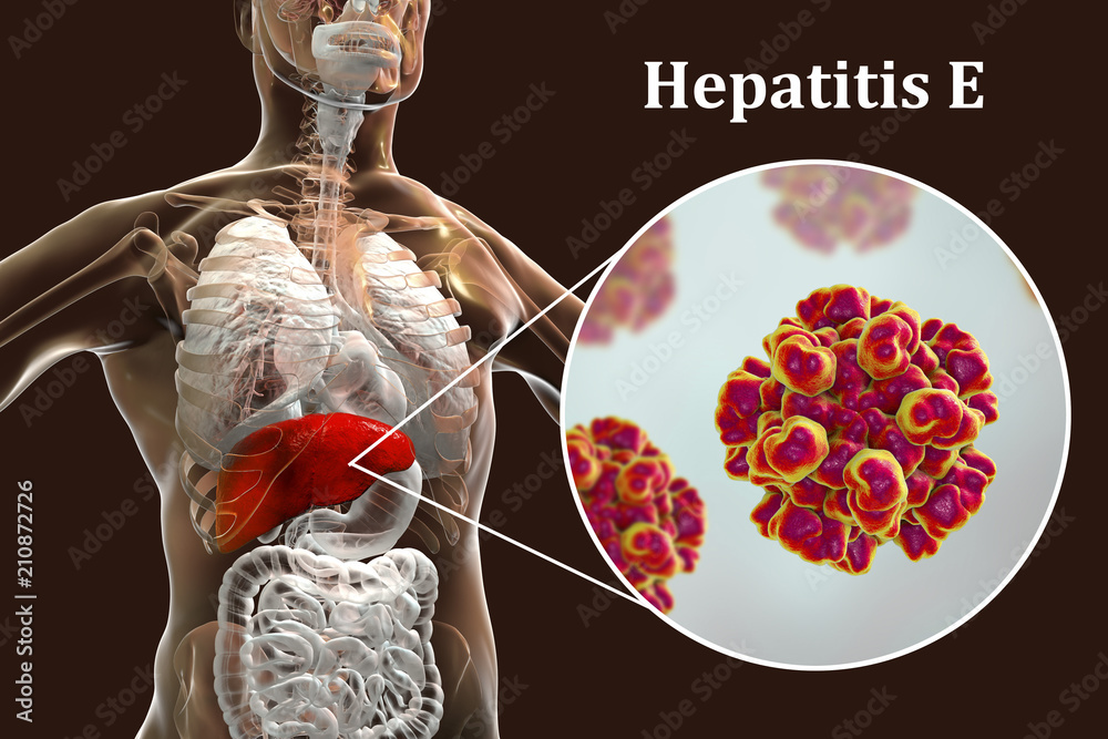 Hepatitis E viral infection, 3D illustration. Non-enveloped RNA viruses ...