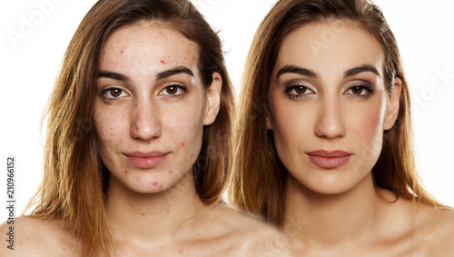 comparition portrait of same woman before and after cosmetic treatment amd makeup on white background