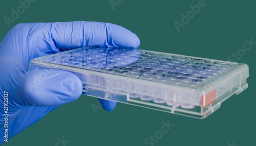 Photos A blue-gloved hand holds a medical plate