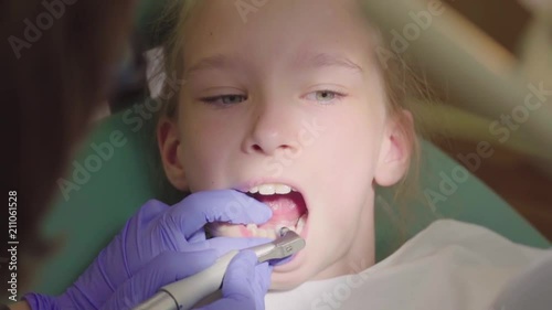 Young girl having her teeth fixed at the dentist's. Caries cleanup. The dentist brushes his teeth with an electric toothbrush photo