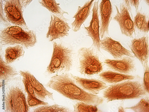 Fotografie Photomicrograph of human endometrial stromal cells stained immunocytochemically for vimentin protein (brown), 40x magnification