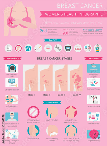 Breast cancer, medical infographic. Diagnostics, symptoms, treatment. Women`s health set