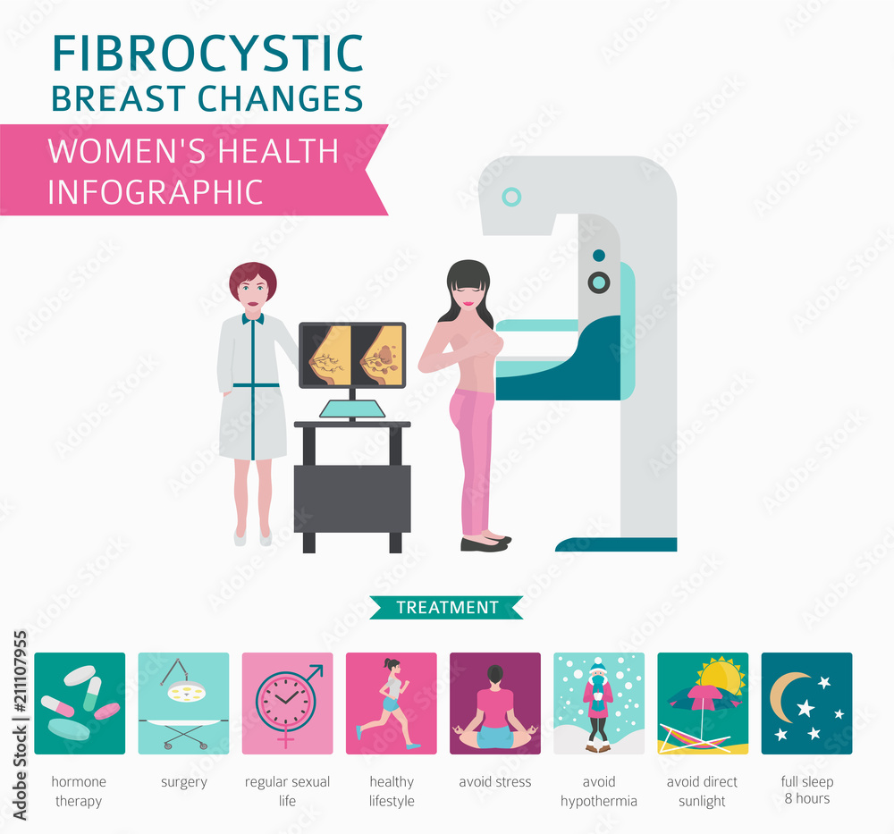 Fibrocystic breast changes disease, medical infographic. Diagnostics, symptoms, treatment. Women`s health icon set