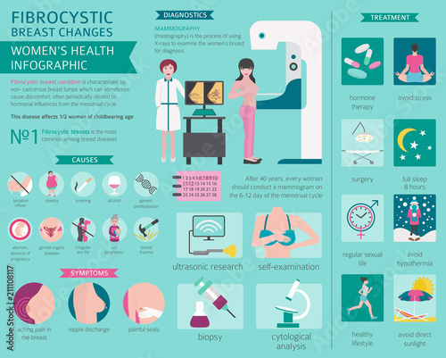 Fibrocystic breast changes disease, medical infographic. Diagnostics, symptoms, treatment. Women`s health icon set