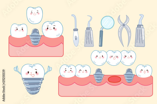 cute cartoon tooth implant