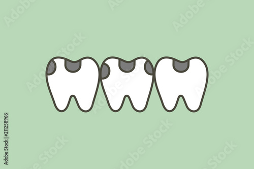 decay tooth or dental caries